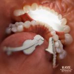 ESCAPISM by RAYE FT 070 SHAKE