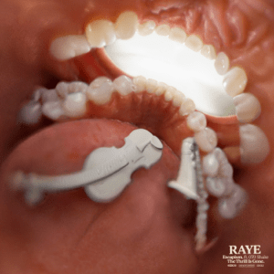 Raye_-_Escapism