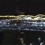 PUGNELLO by GILLA BAND